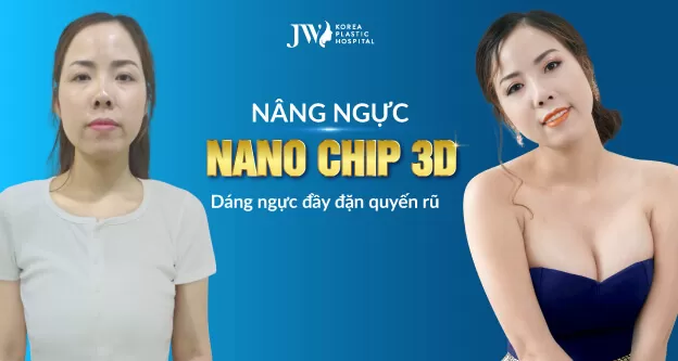 nang-nguc-nano-chip-3d