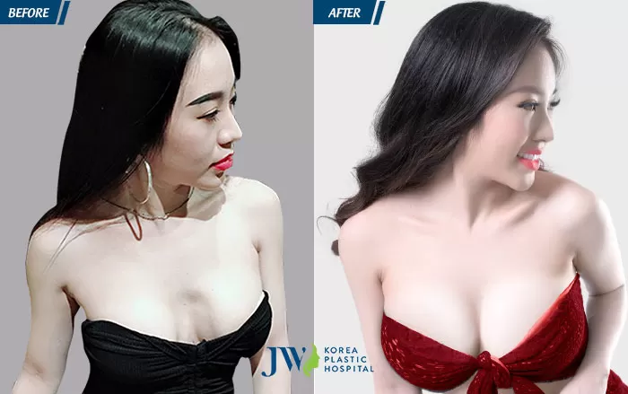 nhung-babie