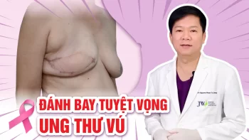 Bệnh viện JW tài trợ 100% cho phụ nữ tái tạo ngực