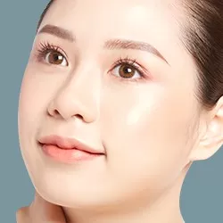 Bấm mí Hàn Quốc