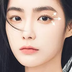 Mở góc mắt ngoài