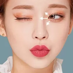 Mở góc mắt trong