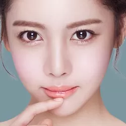 Điều trị lật mi dưới + Căng chỉ