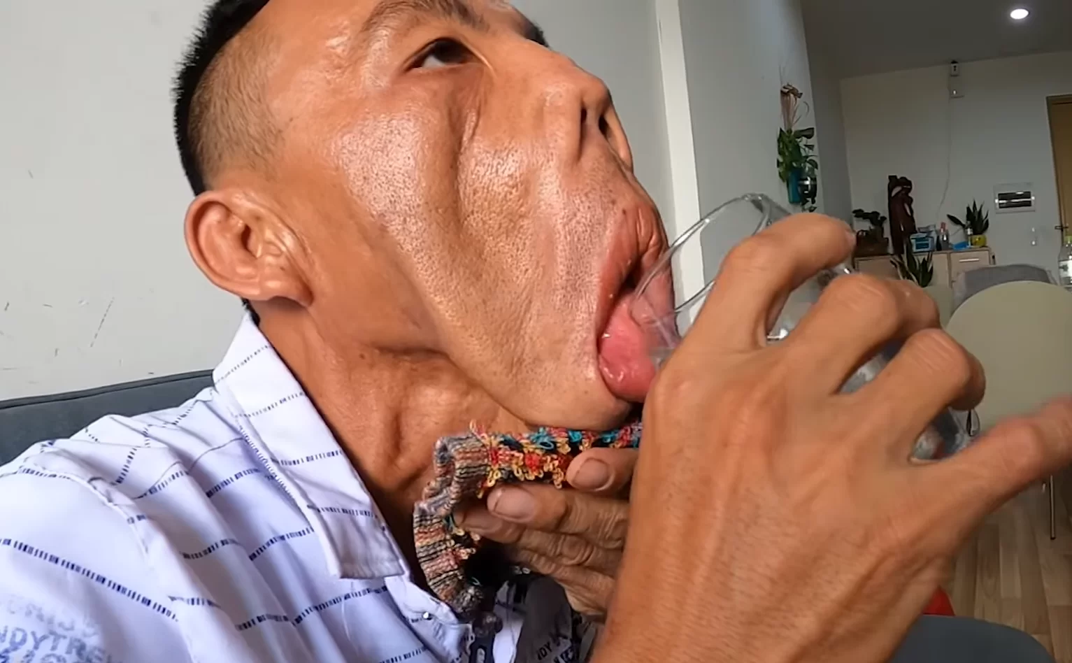 Tia hi vọng của anh Mến sau 15 năm bị xa lánh và chối từ