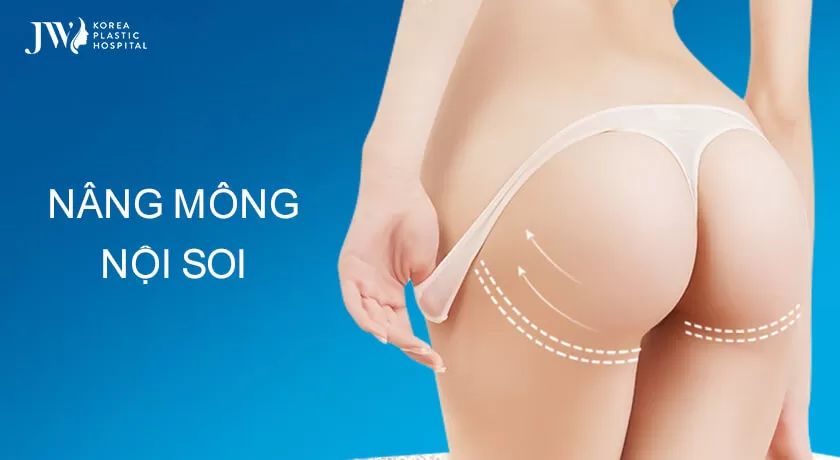 nang-mong-noi-soi
