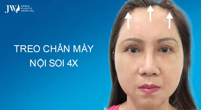 Banner-treo-chan-may-noi-soi-4x