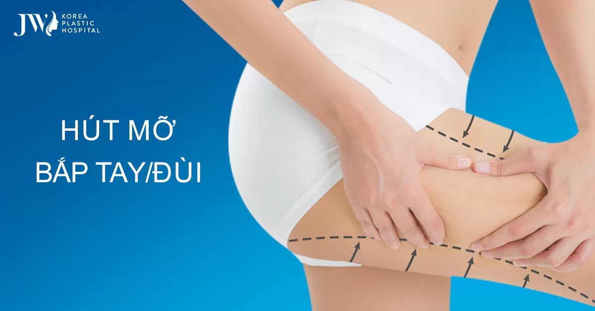 Hút mỡ đùi – Bí quyết “vàng” cho đôi chân quyến rũ