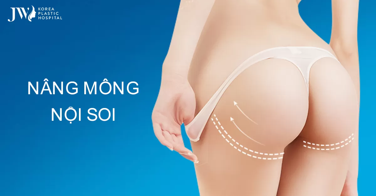 Nâng Mông Nội Soi 4.0: Tôn Tạo Vòng 3 “Lý Tưởng” Cho Phái Đẹp