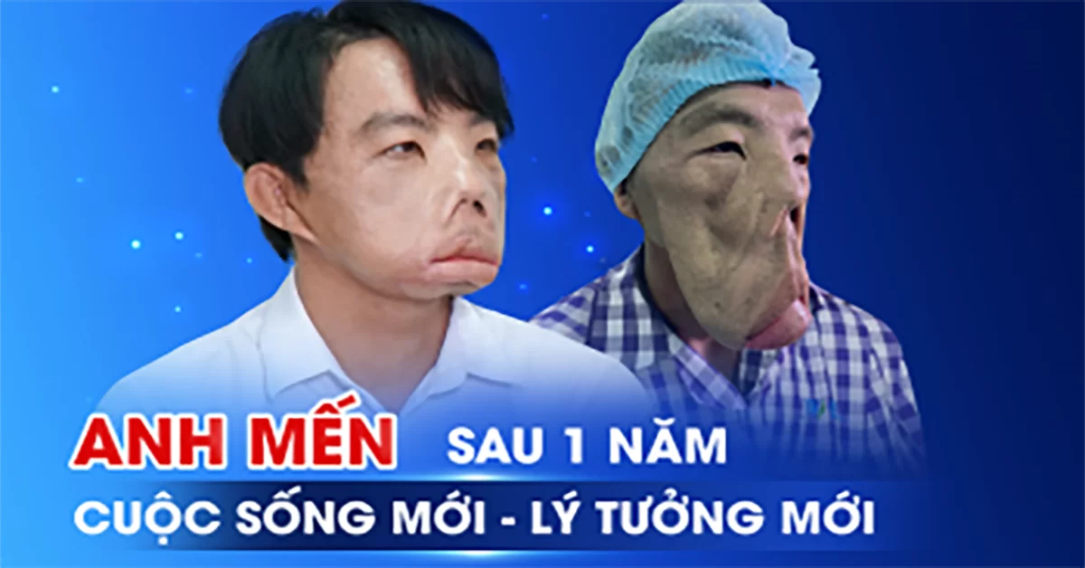 Sau 3 cuộc đại phẫu, anh Mến năm ấy giờ ra sao?