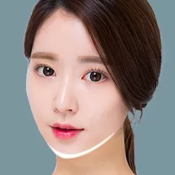Gọt cằm V-Line