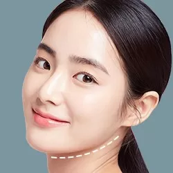 Gọt góc hàm