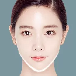 Gọt mặt V-Line