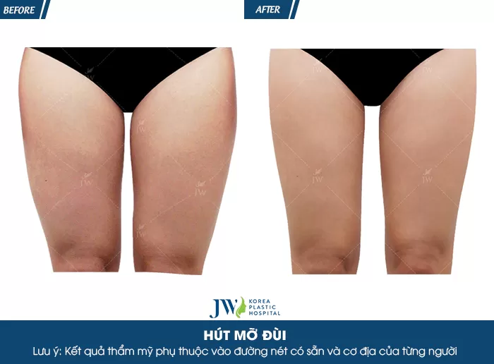 hut mo dui 2