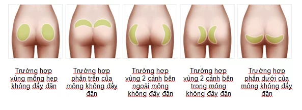 ng-mong-bang-mo-than