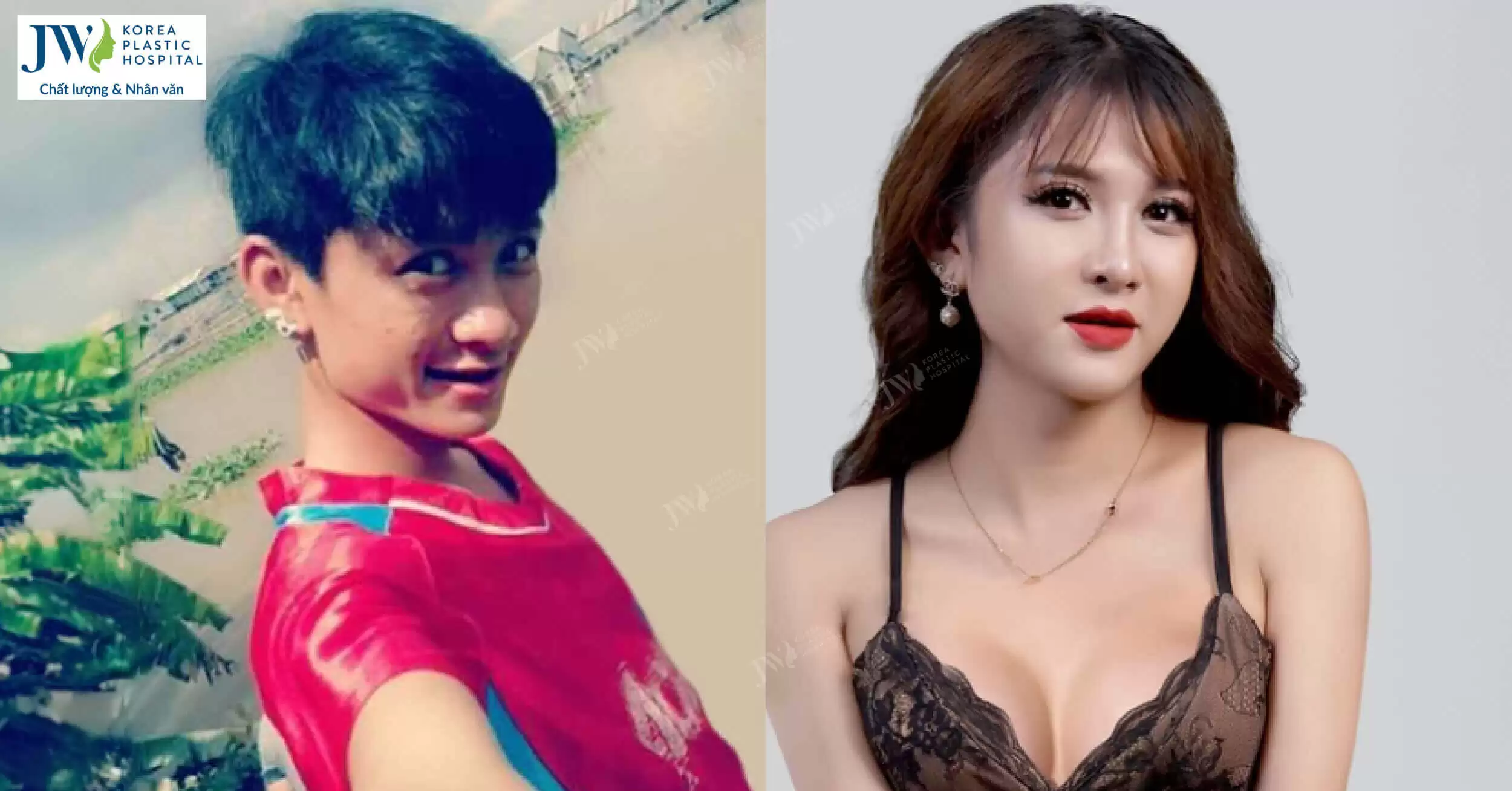“Bóng Long Xuyên” và hành trình gian nan để sống thật với giới tính