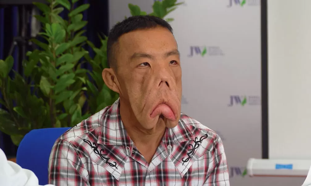 Anh Mến và Lời giải nào cho bác sĩ gây mê?
