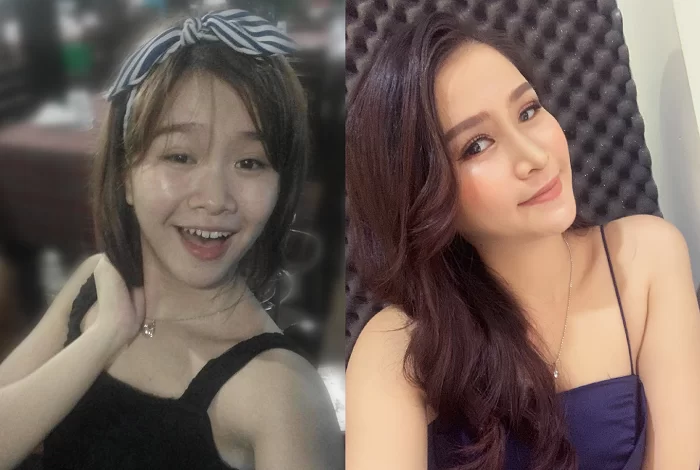 Nữ diễn viên Cổng mặt trời phát cuồng với nhan sắc của cô gái sau nâng mũi