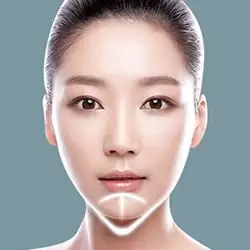 Trượt cằm