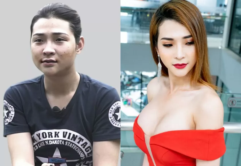 thẩm mỹ