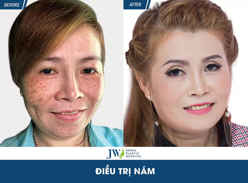 Chị Kim Hưởng