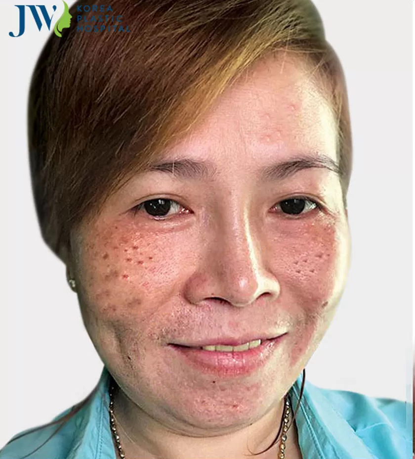 Bệnh nhân nữ