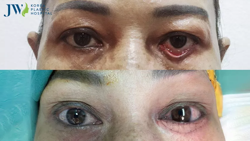before - after