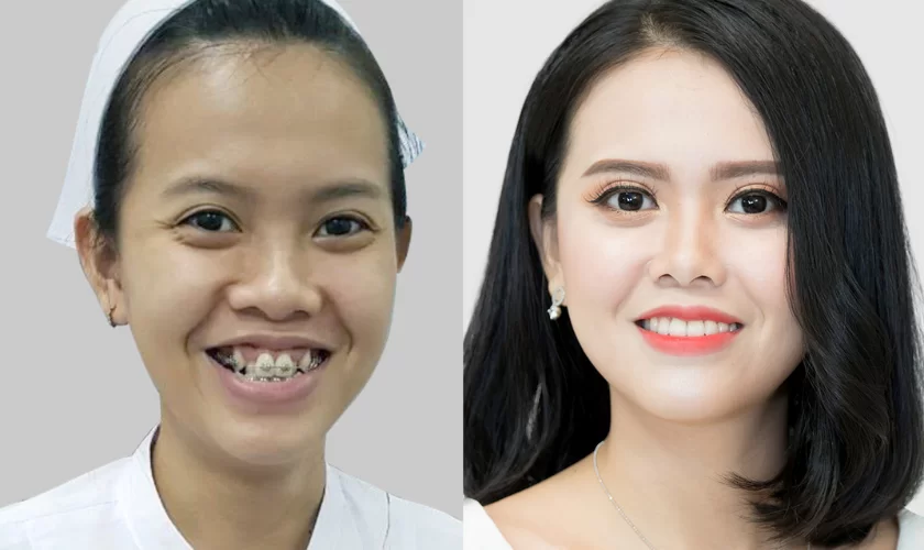 benh-vien-tham-my-cho-tra-gop 