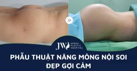 phau-thuat-nang-mong-noi-soi