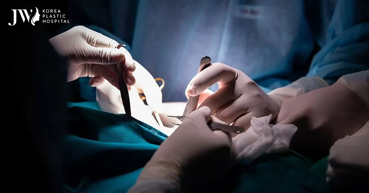 Thẩm mỹ vòng 2 để giảm béo: tìm nơi uy tín để bảo vệ chính mình