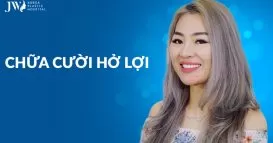 banner-chua-cuoi-ho-loi