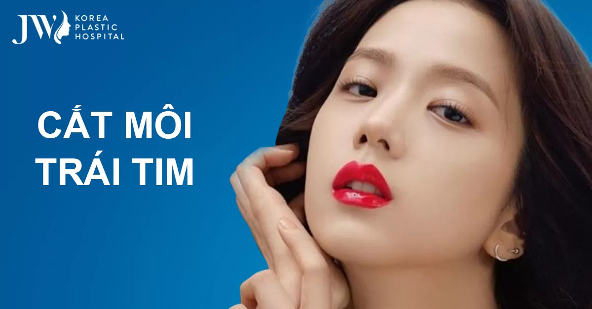 Bảng giá cắt môi trái tim tại Bệnh viện JW năm 2022