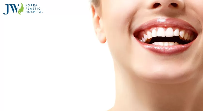 Nguyên nhân gây nên tình trạng răng ố vàng?