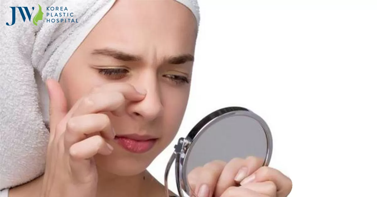 Cách trị mụn trứng cá ở mũi tại nhà cực an toàn hiệu quả