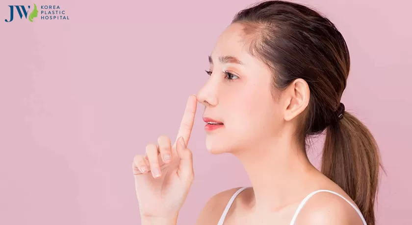 Cắt cánh mũi giúp mũi thon gọn