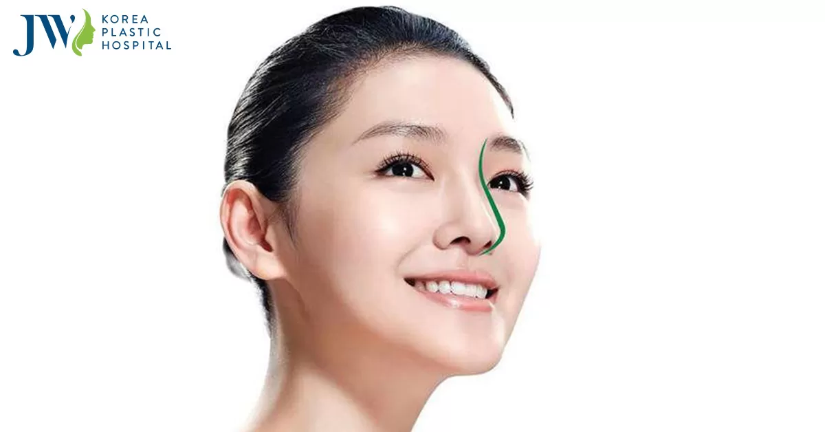 Giải đáp thắc mắc nâng mũi bao lâu thì đẹp cho hội chị em