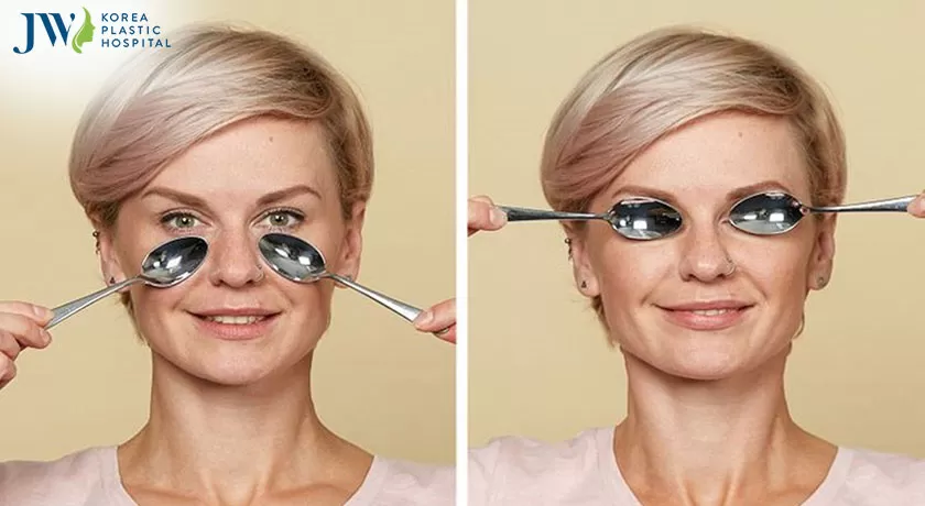 Cách trị bọng mắt dưới bằng cách sử dụng các phương pháp dân gian