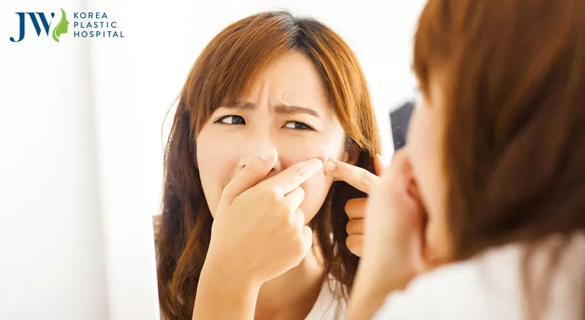 Cách trị mụn cám tận gốc siêu đơn giản ngay tại nhà