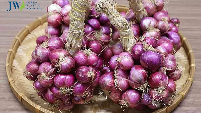 Hành tím hữu hiệu trong việc điều trị thâm mụn