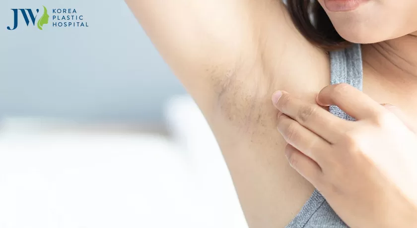 Cách trị thâm nách tự nhiên 