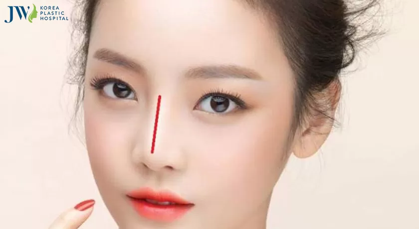Cách khắc phục mũi hếch là gì?