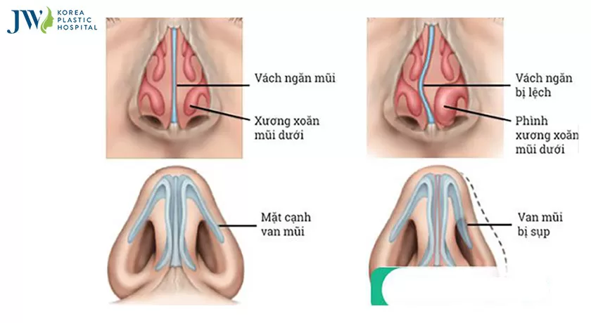 mui-lech-veo