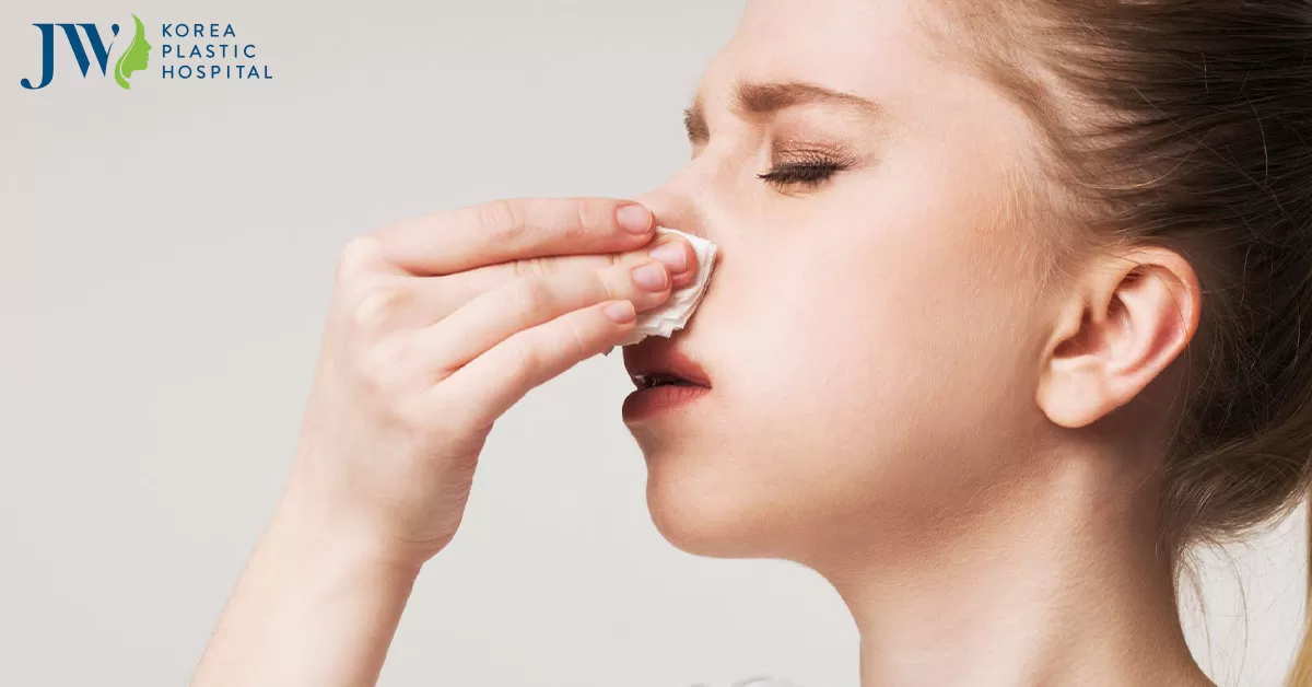 Nâng mũi bị bao xơ có nguy hiểm không? Nguyên nhân và phòng ngừa