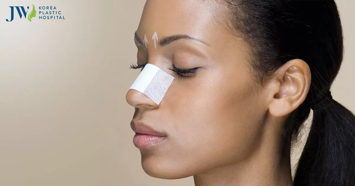 Nâng mũi bị co rút do đâu? Liệu có khắc phục được không?
