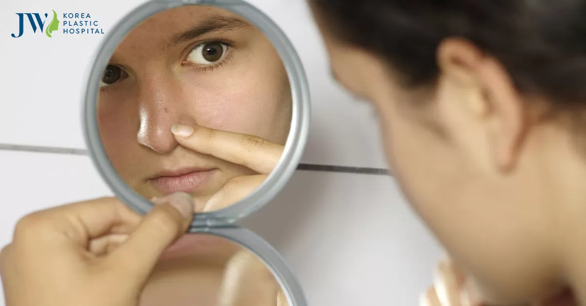 Nâng mũi bị nổi mụn là chuyện bình thường hay bất thường?