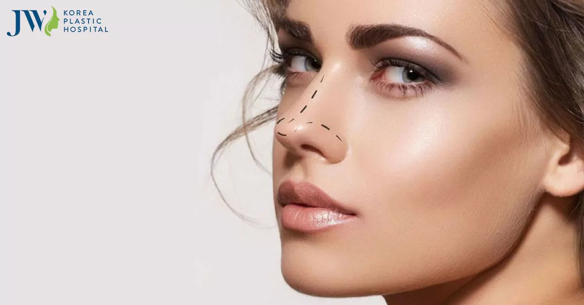 Nâng mũi bọc sụn ở đâu đẹp uy tín? Điều cần biết về nâng mũi bọc sụn