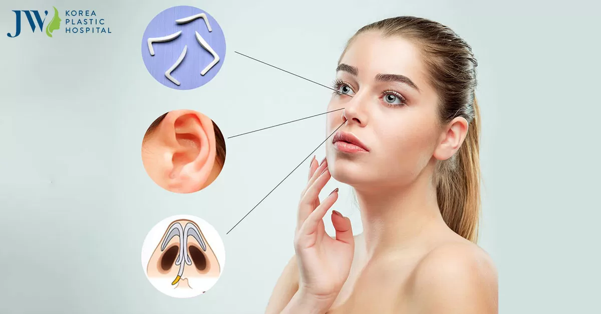 Nâng mũi cấu trúc bao lâu lành hẳn? Lưu ý gì khi nâng mũi cấu trúc?