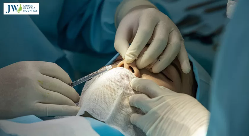 Nâng mũi có nguy hiểm không? Nỗi lo lợ của nhiều người