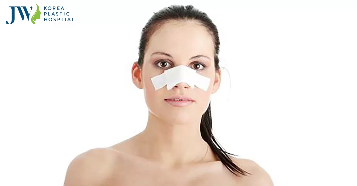 Nâng mũi mấy ngày tháo nẹp? Có nên tự tháo nẹp ở nhà không?