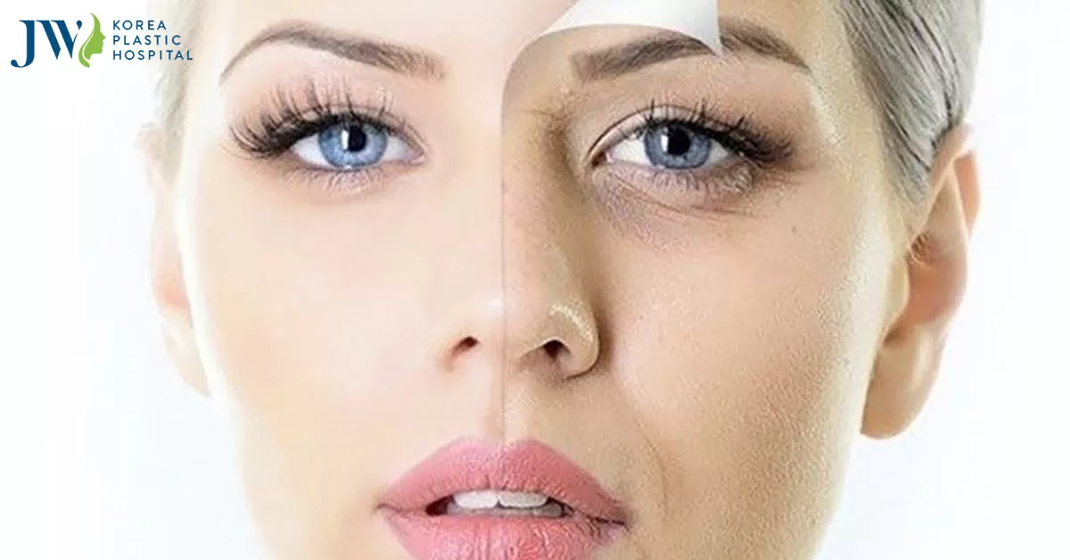 Cách trị quầng thâm mắt lâu năm tại nhà cực kì hữu hiệu bằng 6 cách này