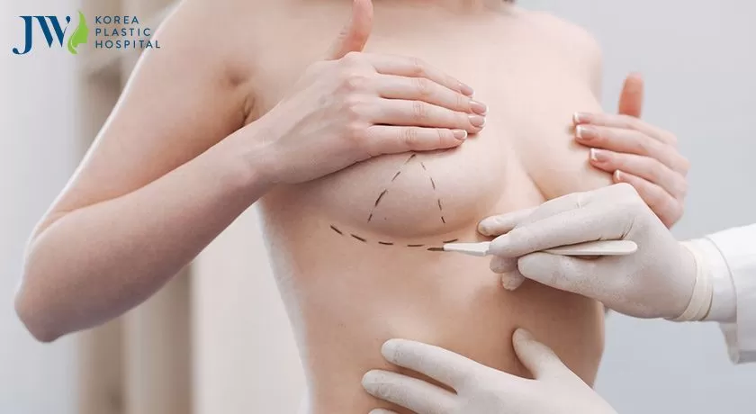 Chuyển giới nam sang nữ bao nhiều tiền